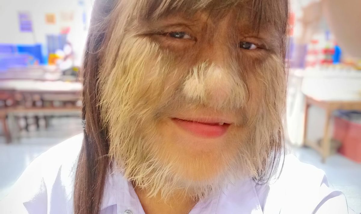 She Decides To Shave After Years The Transformation Of The World's Hairiest Woman Is Astonishing